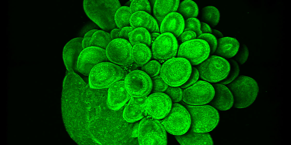 A Blooming Mini Brain by Oksdath Mansilla