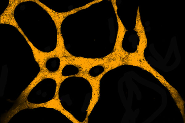 The Tumour Network by Kay Myo Min