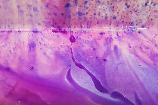 Watercolours of Pathology by Gink Yang