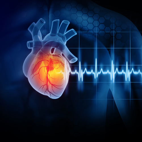 ECG heart monitor pattern