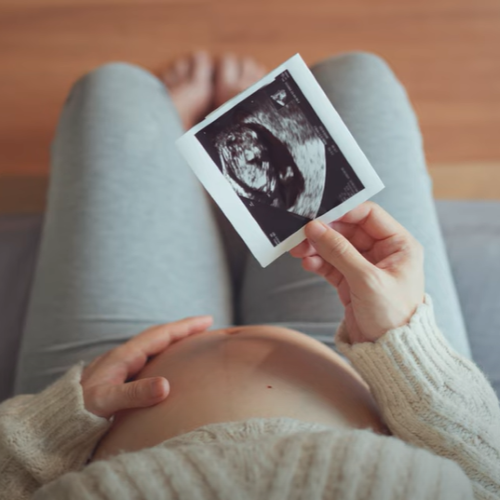 Pregnant woman looking at scan