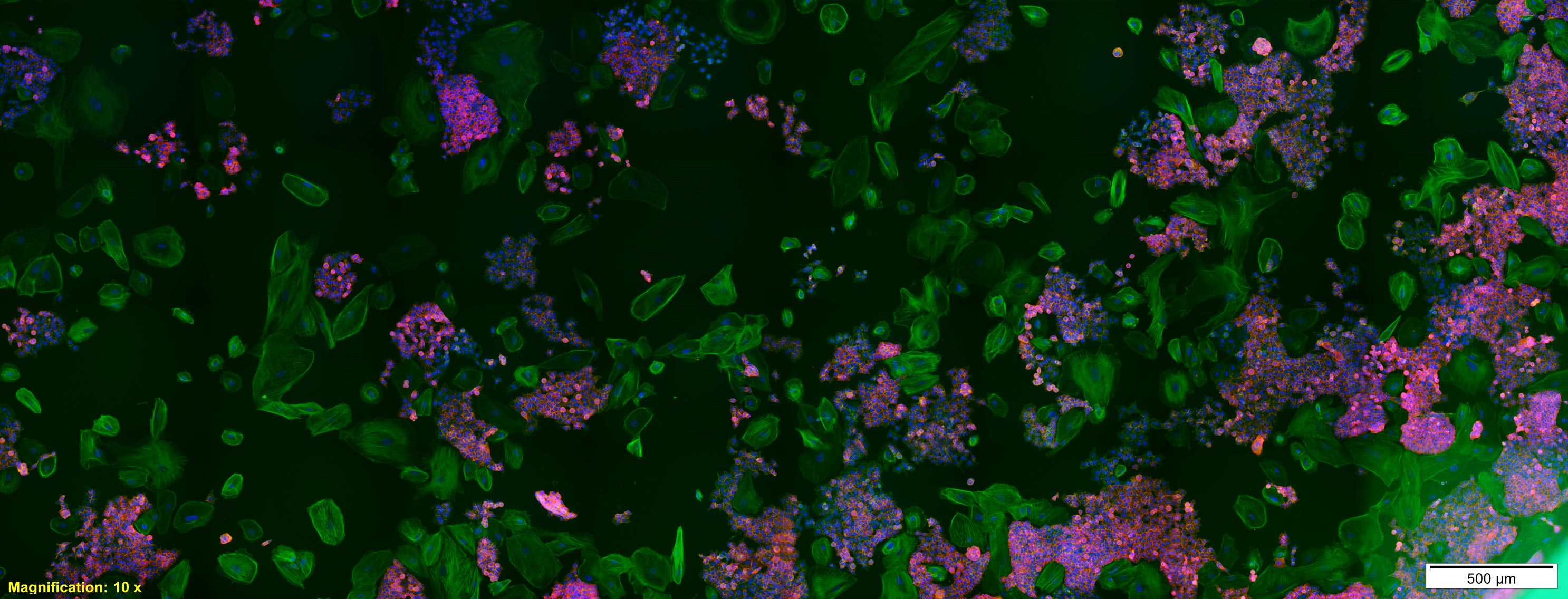 2016 - Highly Commended - Co-culture - Dr Melanie Macgregor-Ramiasa, Research Associate, Future Industries Institute