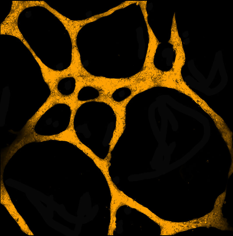 The Tumour Network by Kay Myo Min